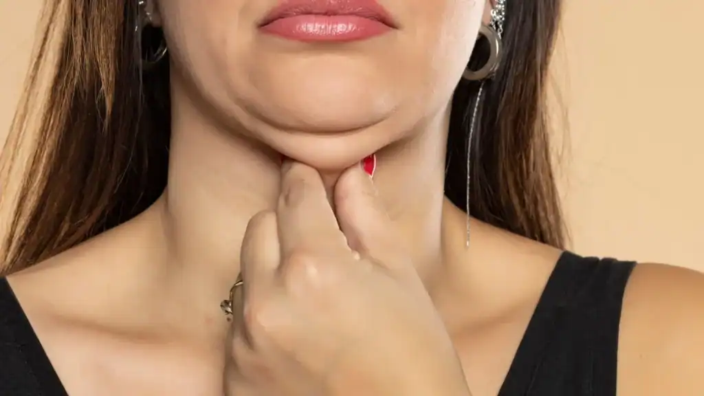 An image of a woman with double chin, sad, worried : Non Surgical Double Chin Removal Treatment in Keighley, UK